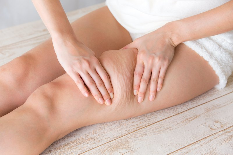 Trattamento cellulite – protocollo combinato Dr. Elsharkawy, Verbania