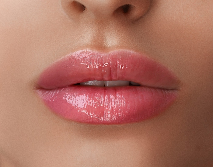 Filler labbra con acido ialuronico – Dr. Elsharkawy, Verbania