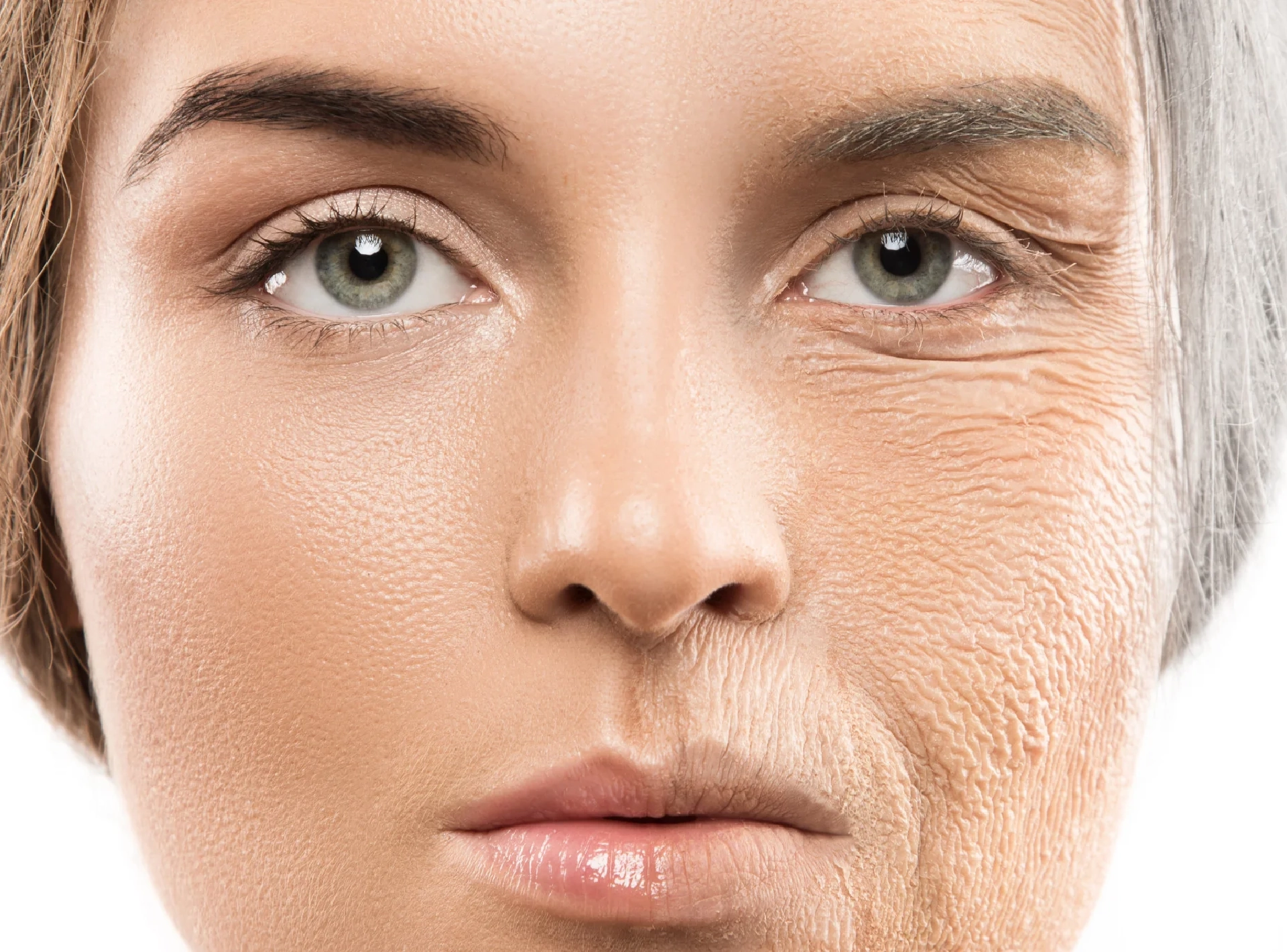 Rughe del viso – botulino e filler Dr. Elsharkawy, Verbania